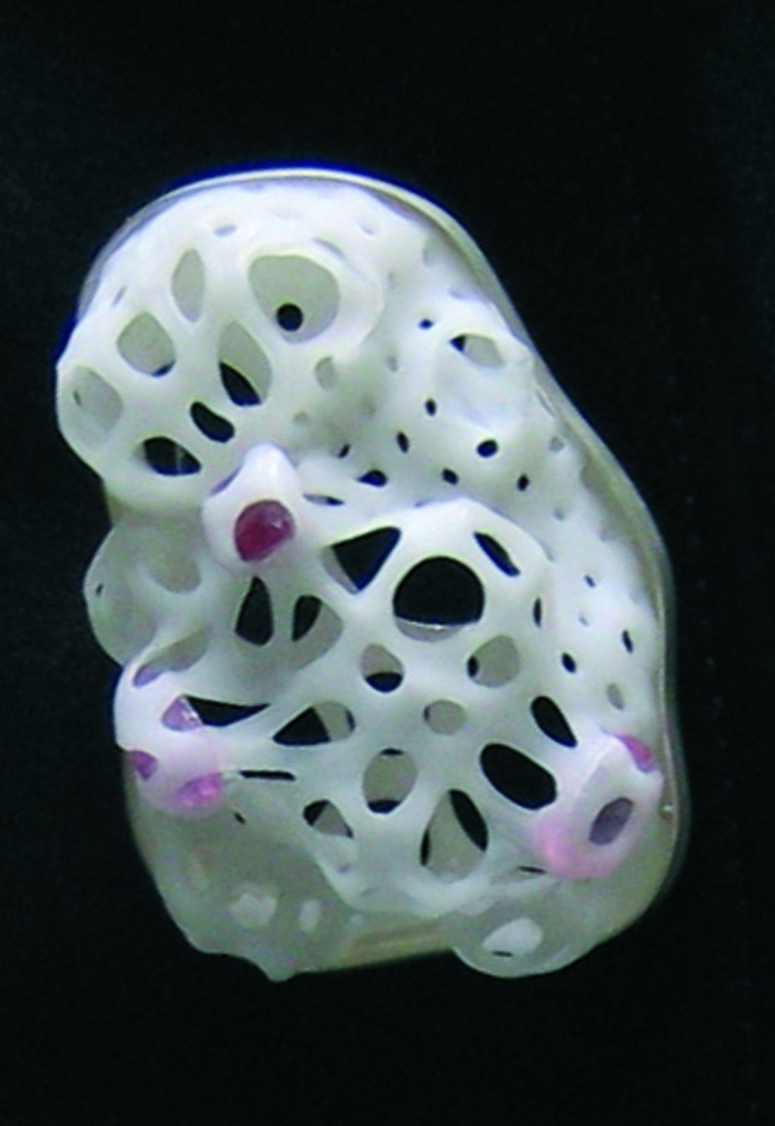 Broche — Expansion, vue 7