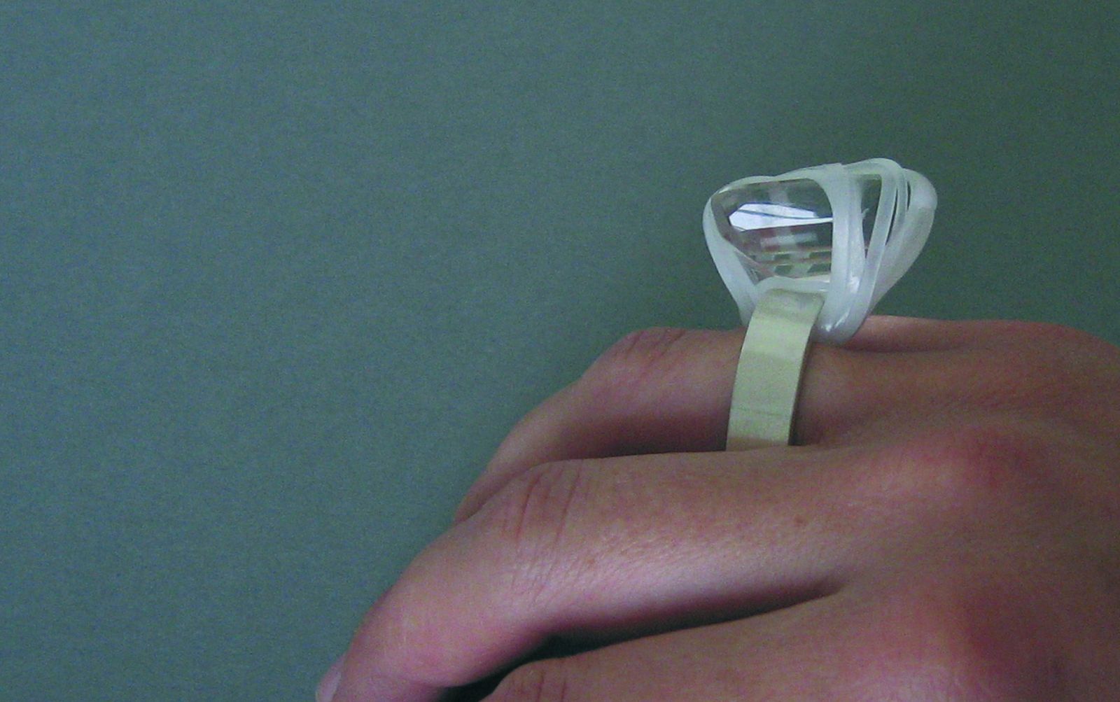 Bague — Expansion, vue 1